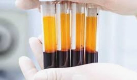 Adarsh Maharashtra | रक्तद्रवदात्यांची तपासणी करण्यासाठी विभागीय स्तरावर सुविधा ;गैरसोय होऊ...