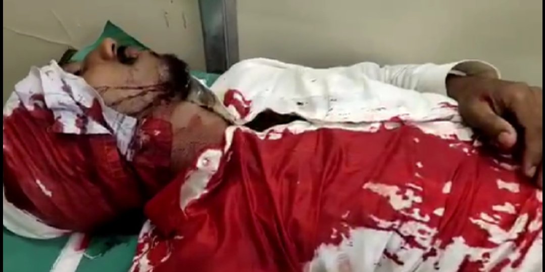 Adarsh Maharashtra | वाढदिवसाच्या पार्टीत मित्रांनी केलेल्या मारहाणीत युवक जबर जखमी