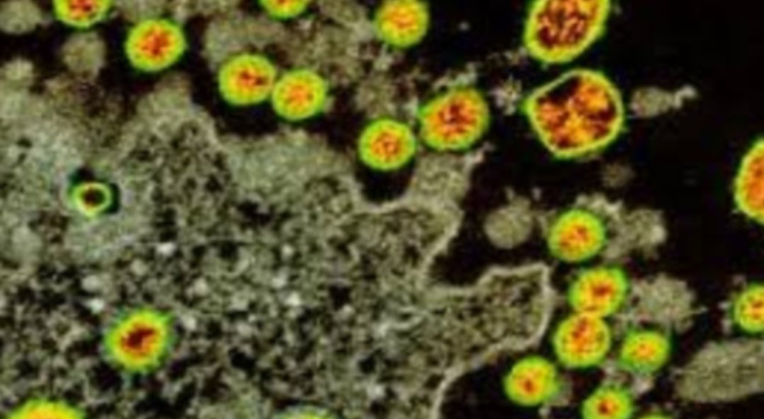 Adarsh Maharashtra | पालिकेचा कोरोना लढा यशस्वी होतोय  मुंबईचा कोरोना डबलिंग रेट २७ दिवसांवर