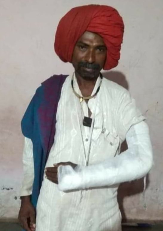 Adarsh Maharashtra | मेंढपाळ सोमनाथ कोकरे यांना मारहाण,मेंढपाळावरील हल्ल्याचे सत्र काही...