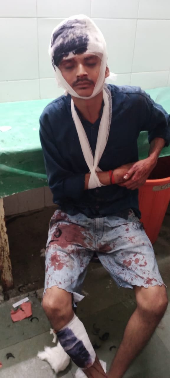 Adarsh Maharashtra | कल्याण-मलंगगड रोडवरील धक्कादायक घटना वॉचमनवर प्राणघातक हल्ला...