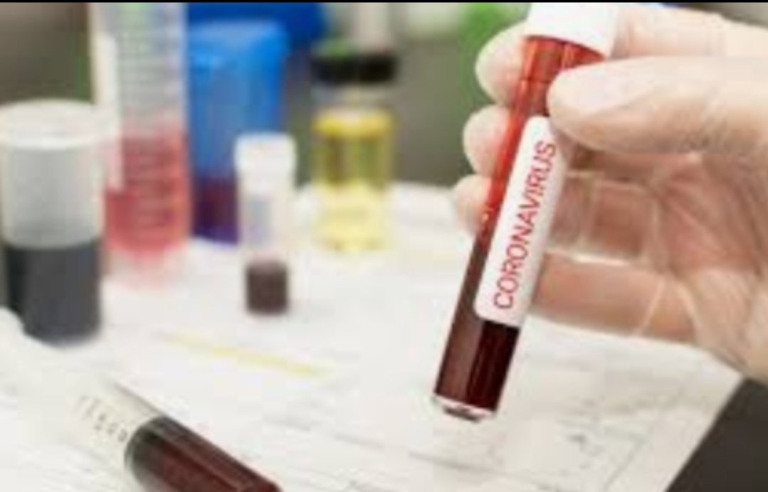 Adarsh Maharashtra | अकोलेच्या लेकीचा शोध! अवघ्या १५ मिनिटांत कोरोनाचे निदान; किटला...